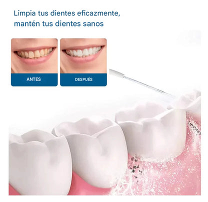 Irrigador Oral Eléctrico ® [PAGA 1 y LLEVA 2]