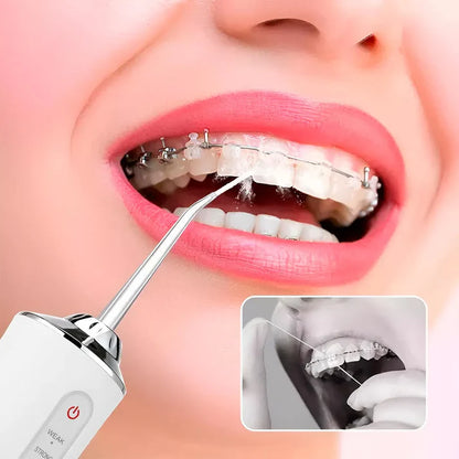 Irrigador Oral Eléctrico ® [PAGA 1 y LLEVA 2]