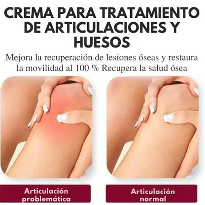 PerfectX ® - Terapia Articular y Muscular [PAGA 1 y LLEVA 2]