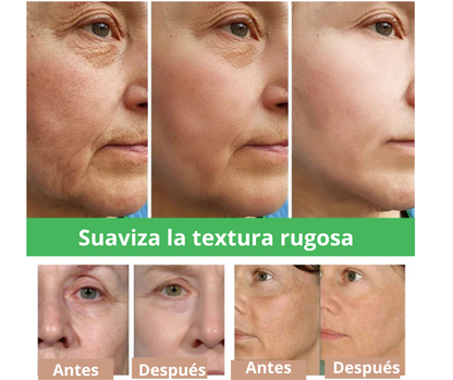 Removedor instantáneo de arrugas - Suero facial Anti envejecimiento [COMPRA 1 Y OBTÉN OTRO GRATIS]